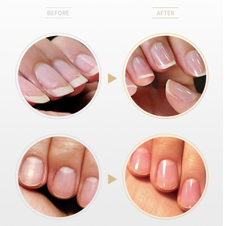 How to Buff Your Nails: 11 Steps (with Pictures) - wikiHow